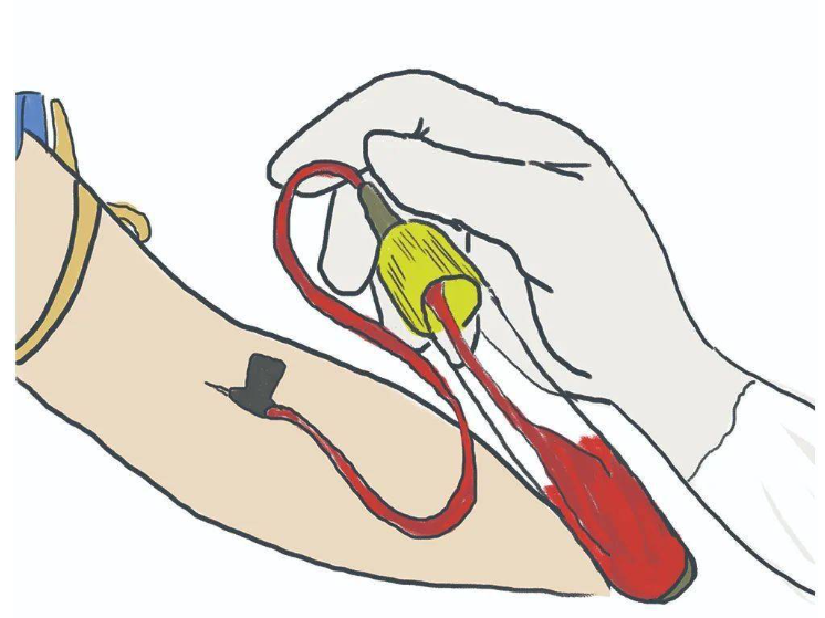 抽血检验的相关知识点，请收悉